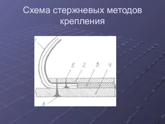 Схема стержневых методов крепления