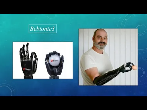 Bebionic3