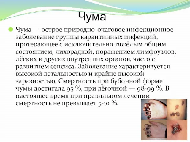 Чума Чума — острое природно-очаговое инфекционное заболевание группы карантинных инфекций, протекающее