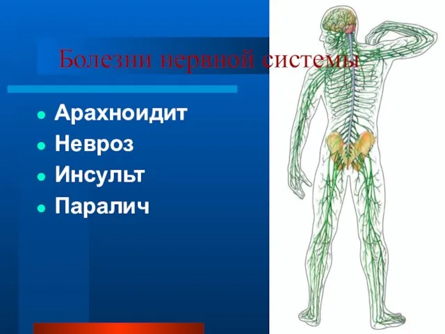 Болезни нервной системы Арахноидит Невроз Инсульт Паралич