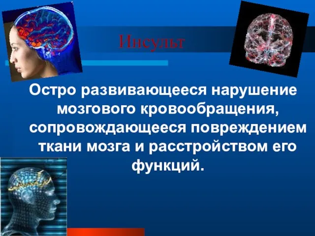 Инсульт Остро развивающееся нарушение мозгового кровообращения, сопровождающееся повреждением ткани мозга и расстройством его функций.