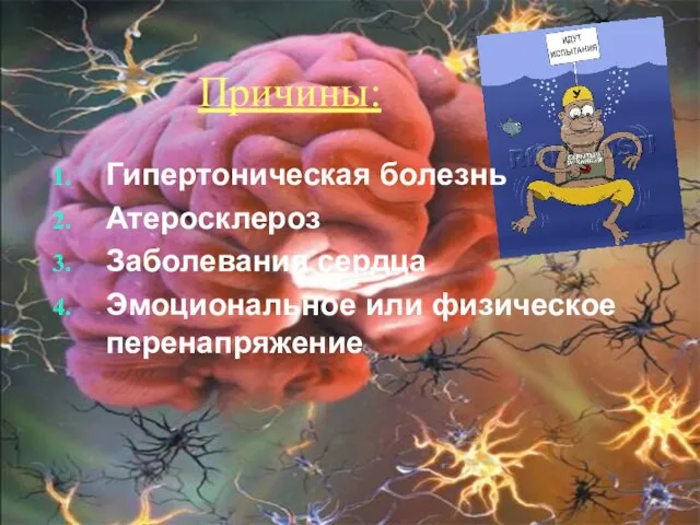 Причины: Гипертоническая болезнь Атеросклероз Заболевания сердца Эмоциональное или физическое перенапряжение