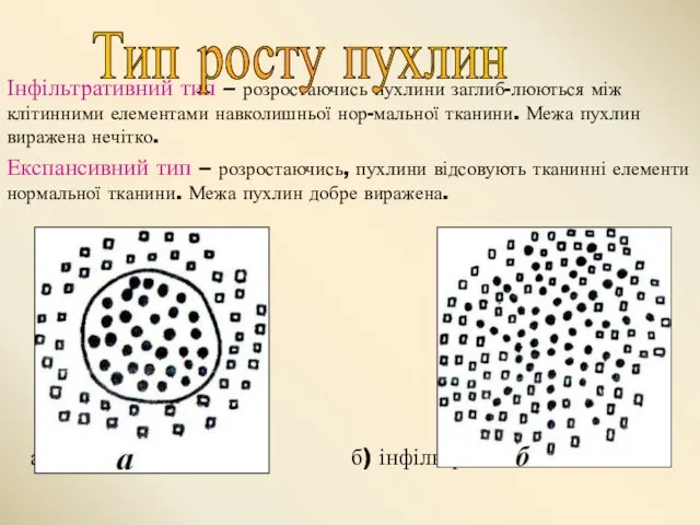 Інфільтративний тип – розростаючись пухлини заглиб-люються між клітинними елементами навколишньої нор-мальної