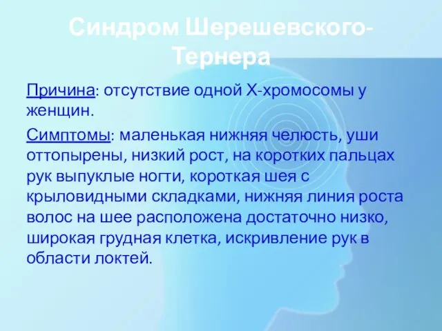 Синдром Шерешевского-Тернера Причина: отсутствие одной Х-хромосомы у женщин. Симптомы: маленькая нижняя