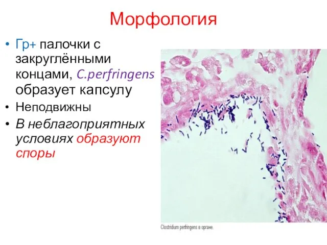 Морфология Гр+ палочки с закруглёнными концами, C.perfringens образует капсулу Неподвижны В неблагоприятных условиях образуют споры