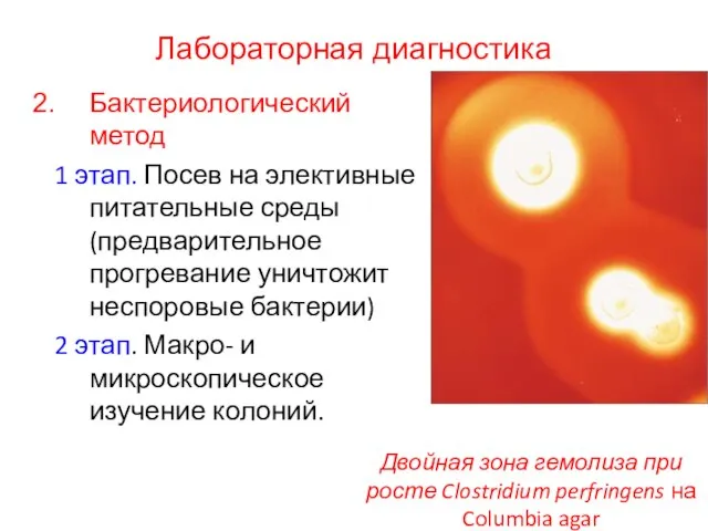 Лабораторная диагностика Бактериологический метод 1 этап. Посев на элективные питательные среды