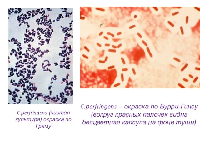 C.рerfringens (чистая культура) окраска по Граму C.рerfringens – окраска по Бурри-Гинсу