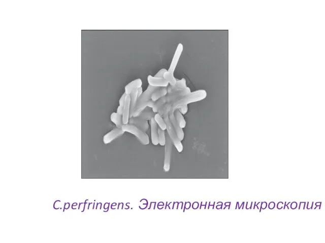 C.perfringens. Электронная микроскопия