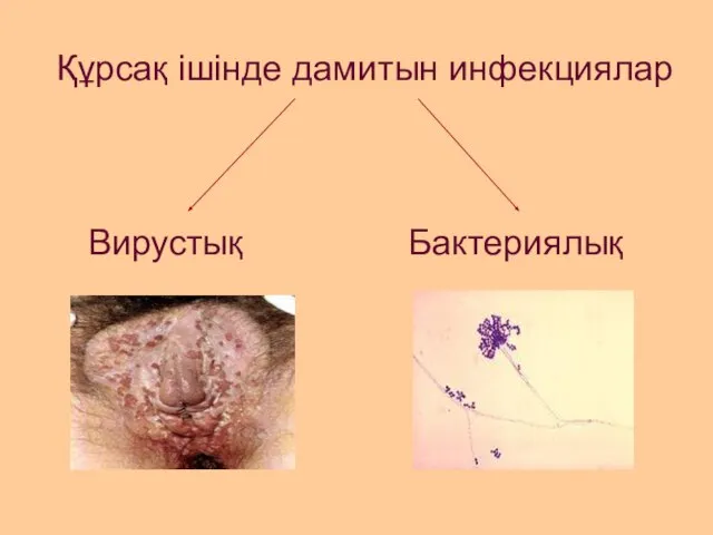 Құрсақ ішінде дамитын инфекциялар Вирустық Бактериялық