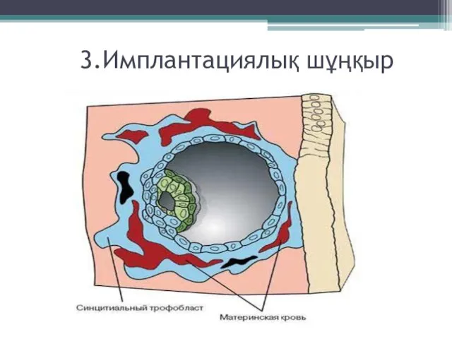 3.Имплантациялық шұңқыр