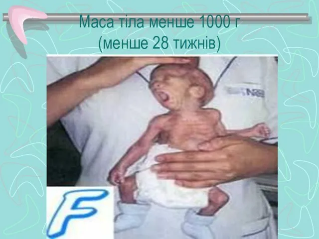 Маса тіла менше 1000 г (менше 28 тижнів)