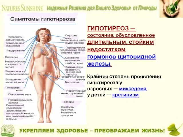 ГИПОТИРЕОЗ — состояние, обусловленное длительным, стойким недостатком гормонов щитовидной железы. Крайняя