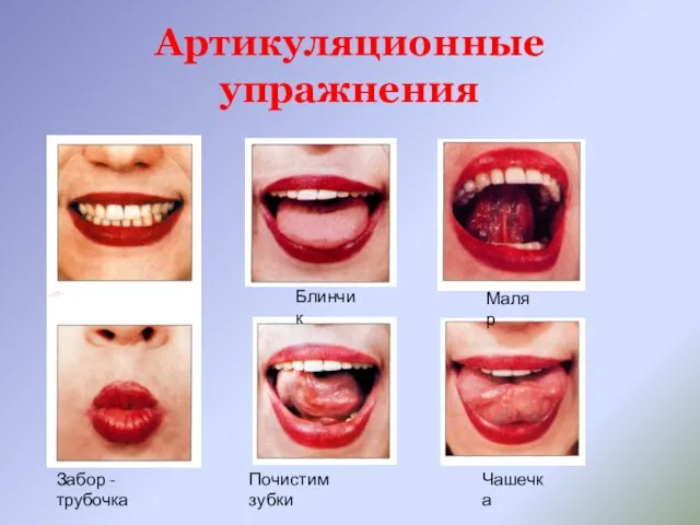 Артикуляционные упражнения Забор - трубочка Почистим зубки Блинчик Маляр Чашечка