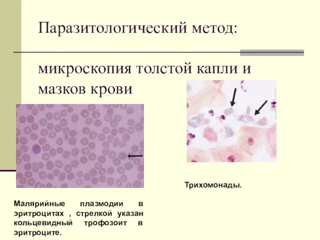 Паразитологический метод: микроскопия толстой капли и мазков крови Малярийные плазмодии в