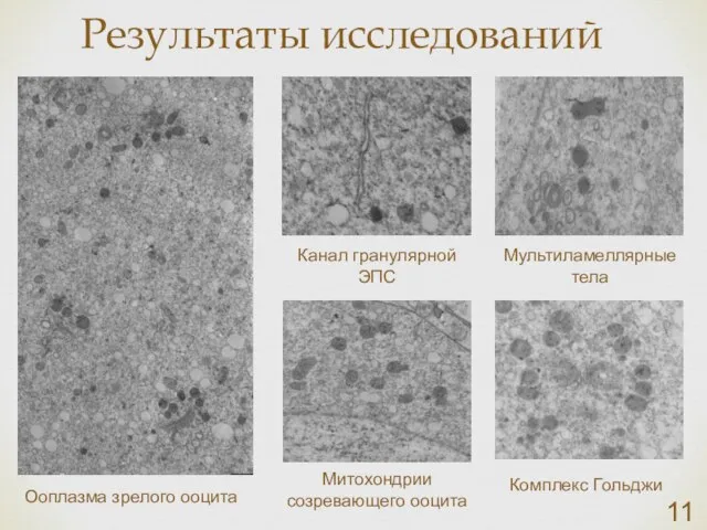 Результаты исследований Ооплазма зрелого ооцита Канал гранулярной ЭПС Мультиламеллярные тела Митохондрии созревающего ооцита Комплекс Гольджи