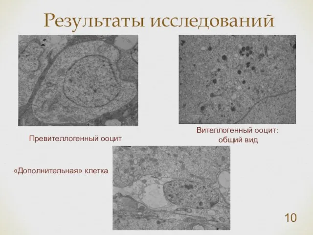 Результаты исследований Превителлогенный ооцит Вителлогенный ооцит: общий вид «Дополнительная» клетка