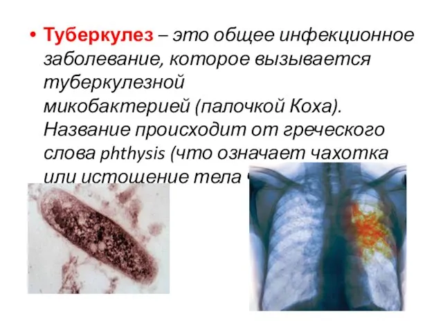 Туберкулез – это общее инфекционное заболевание, которое вызывается туберкулезной микобактерией (палочкой