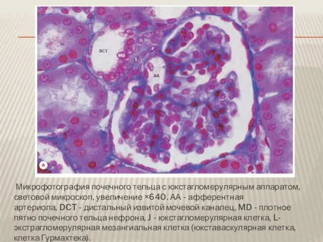 Микрофотография почечного тельца с юкстагломерулярным аппаратом, световой микроскоп, увеличение ×640. АА