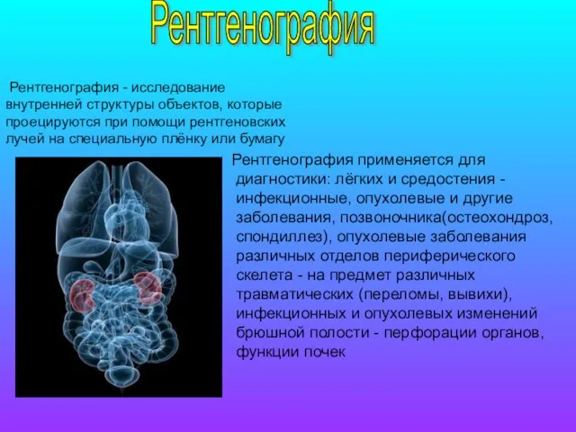 Рентгенография применяется для диагностики: лёгких и средостения - инфекционные, опухолевые и