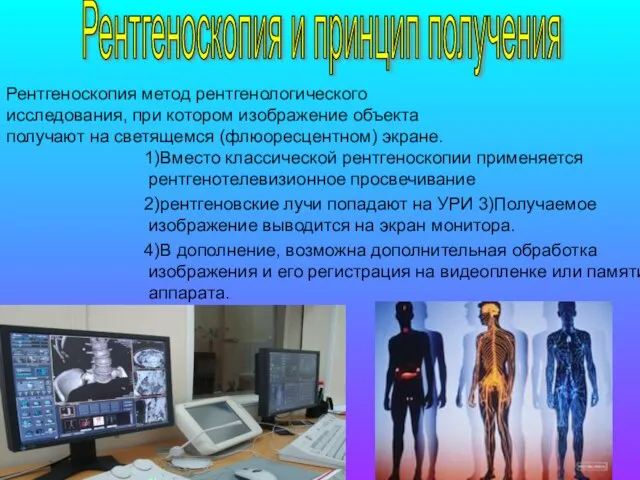 1)Вместо классической рентгеноскопии применяется рентгенотелевизионное просвечивание 2)рентгеновские лучи попадают на УРИ