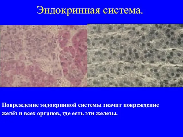 Эндокринная система. Повреждение эндокринной системы значит повреждение желёз и всех органов, где есть эти железы.