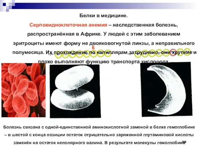 Белки в медицине. Серповидноклеточная анемия – наследственная болезнь, распространённая в Африке.