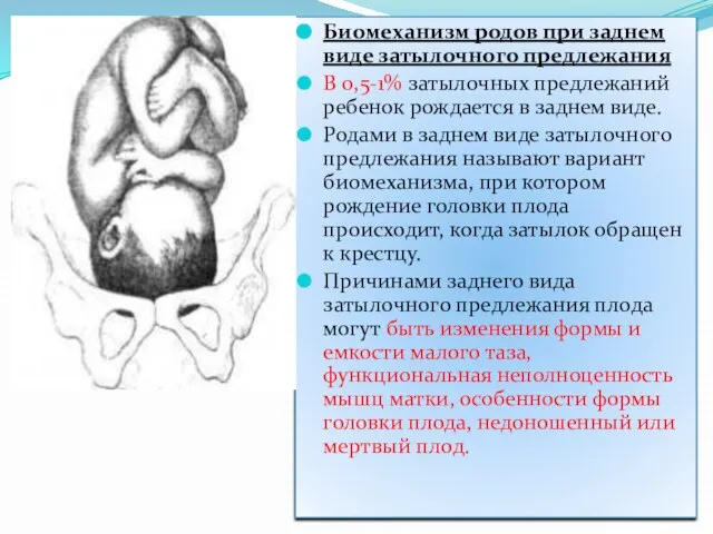 Биомеханизм родов при заднем виде затылочного предлежания В 0,5-1% затылочных предлежаний