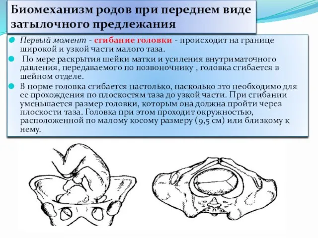 Первый момент - сгибание головки - происходит на границе широкой и