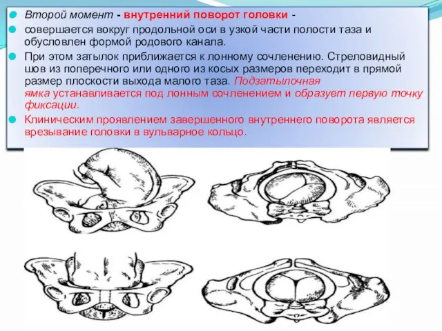 Второй момент - внутренний поворот головки - совершается вокруг продольной оси