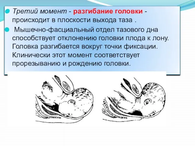 Третий момент - разгибание головки - происходит в плоскости выхода таза