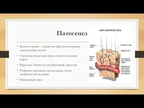 Патогенез Входные ворота - слизистая оболочка верхних дыхательных путей Первичная репликация