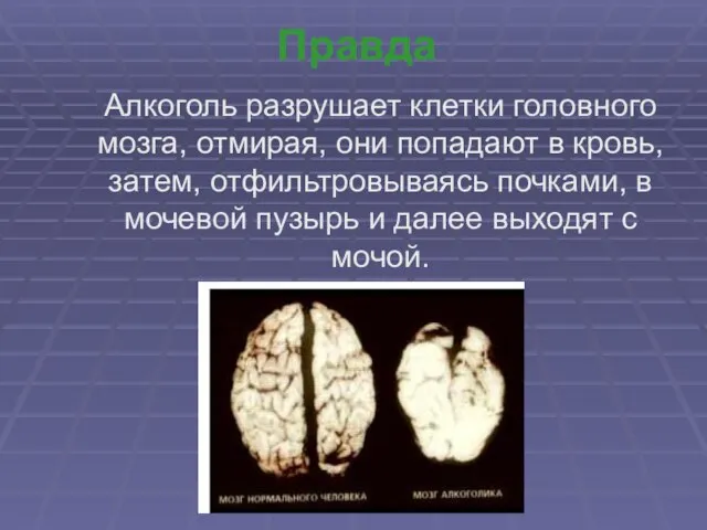 Правда Алкоголь разрушает клетки головного мозга, отмирая, они попадают в кровь,