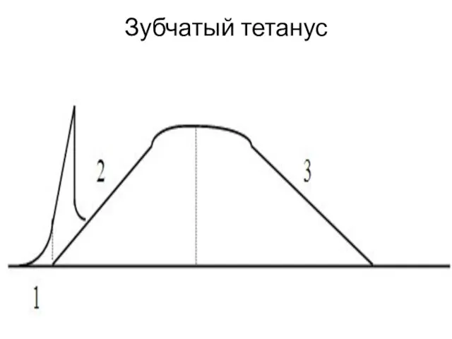 Зубчатый тетанус