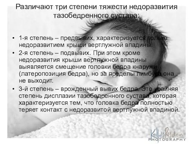 Различают три степени тяжести недоразвития тазобедренного сустава: 1-я степень – предвывих,