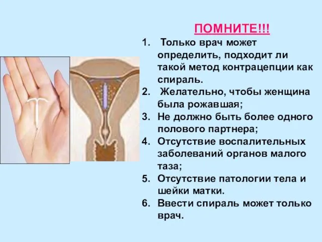 ПОМНИТЕ!!! Только врач может определить, подходит ли такой метод контрацепции как