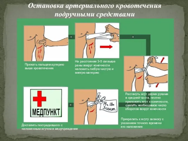 Остановка артериального кровотечения подручными средствами Прижать пальцем артерию выше кровотечения На