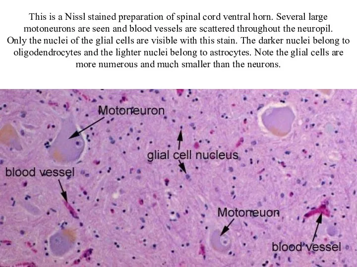 This is a Nissl stained preparation of spinal cord ventral horn.