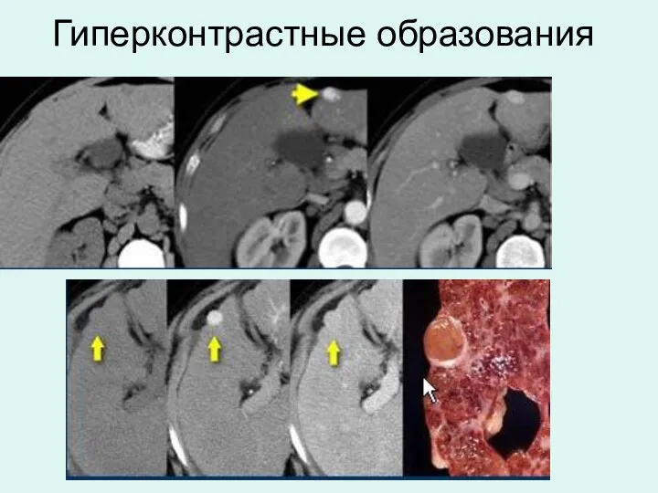 Гиперконтрастные образования