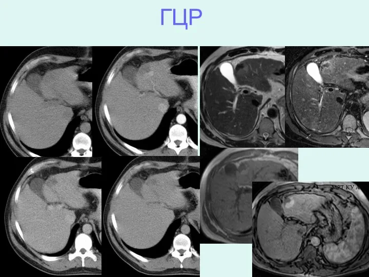 ГЦР МРТ КУ АФ