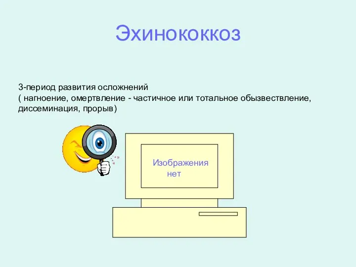 Эхинококкоз 3-период развития осложнений ( нагноение, омертвление - частичное или тотальное обызвествление, диссеминация, прорыв) Изображения нет