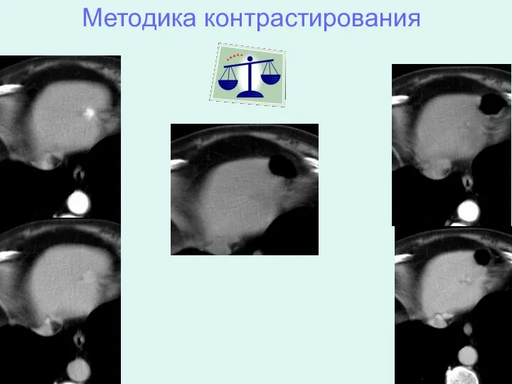 Методика контрастирования