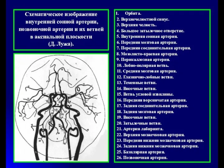 Схематическое изображение внутренней cонной артерии, позвоночной артерии и их ветвей в