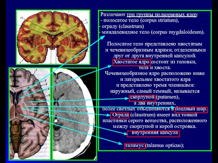 Различают три группы подкорковых ядер: - полосатое тело (corpus striatum), ограду