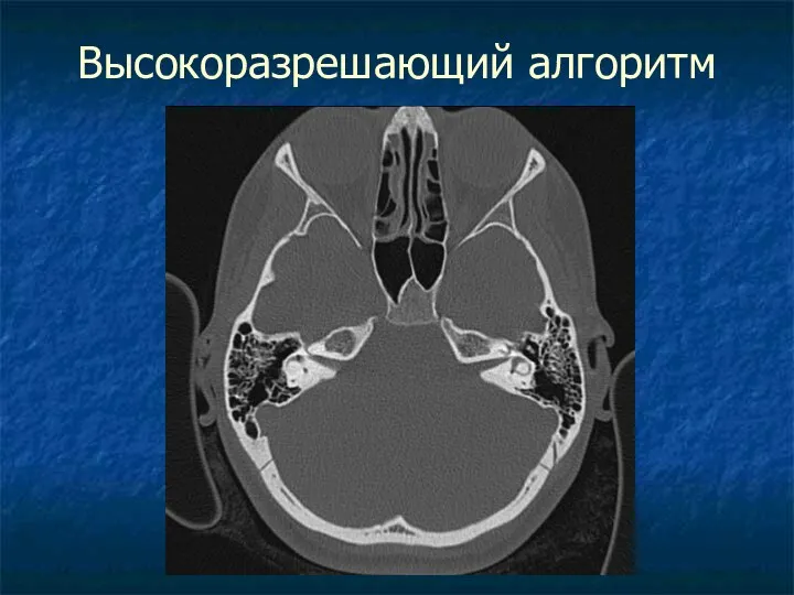 Высокоразрешающий алгоритм