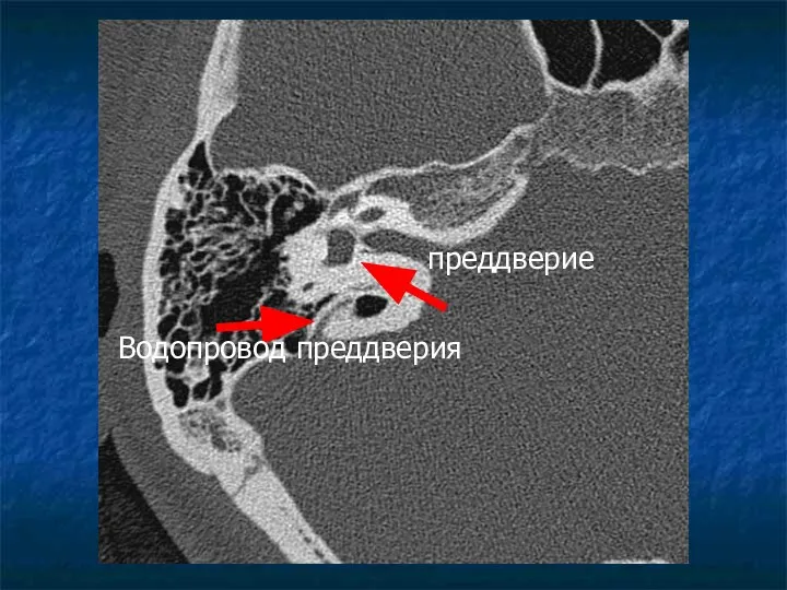 Водопровод преддверия преддверие