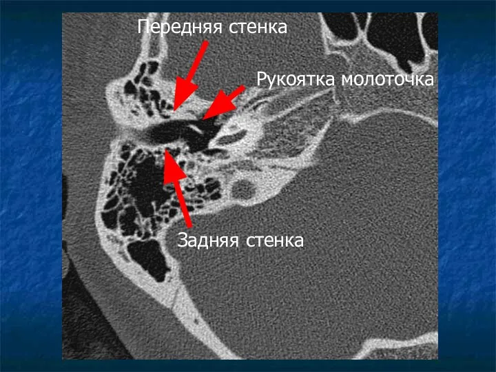 Передняя стенка Задняя стенка Рукоятка молоточка