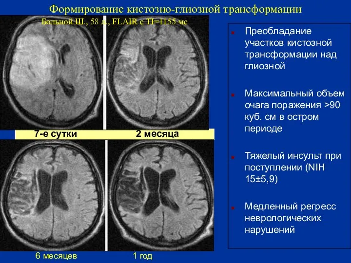 7-е сутки 2 месяца Преобладание участков кистозной трансформации над глиозной Максимальный