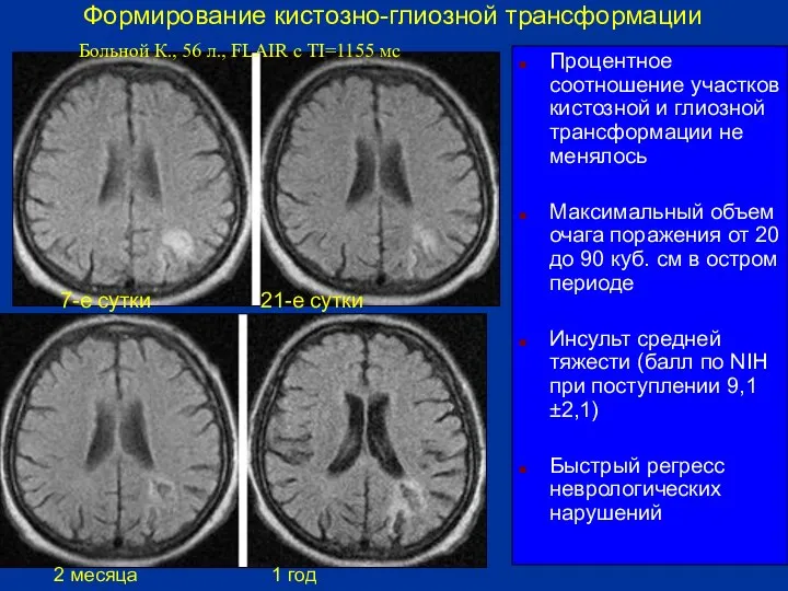 Процентное соотношение участков кистозной и глиозной трансформации не менялось Максимальный объем