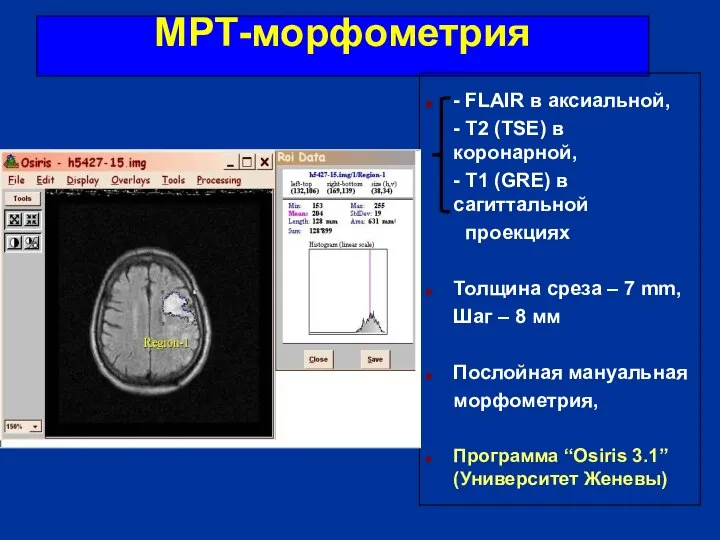 МРТ-морфометрия - FLAIR в аксиальной, - T2 (TSE) в коронарной, -