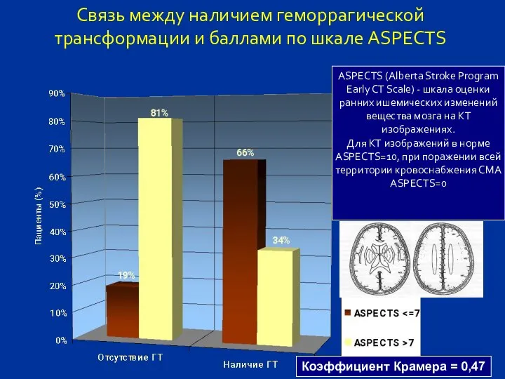 Связь между наличием геморрагической трансформации и баллами по шкале ASPECTS ASPECTS